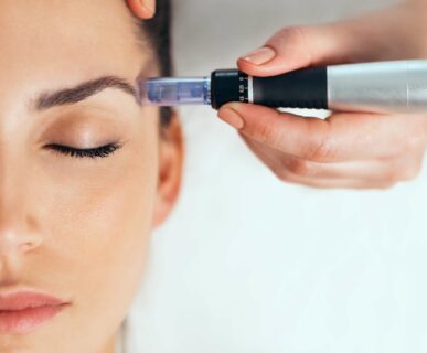 Microneedling at Aesthete Beauty Salon, Dundee