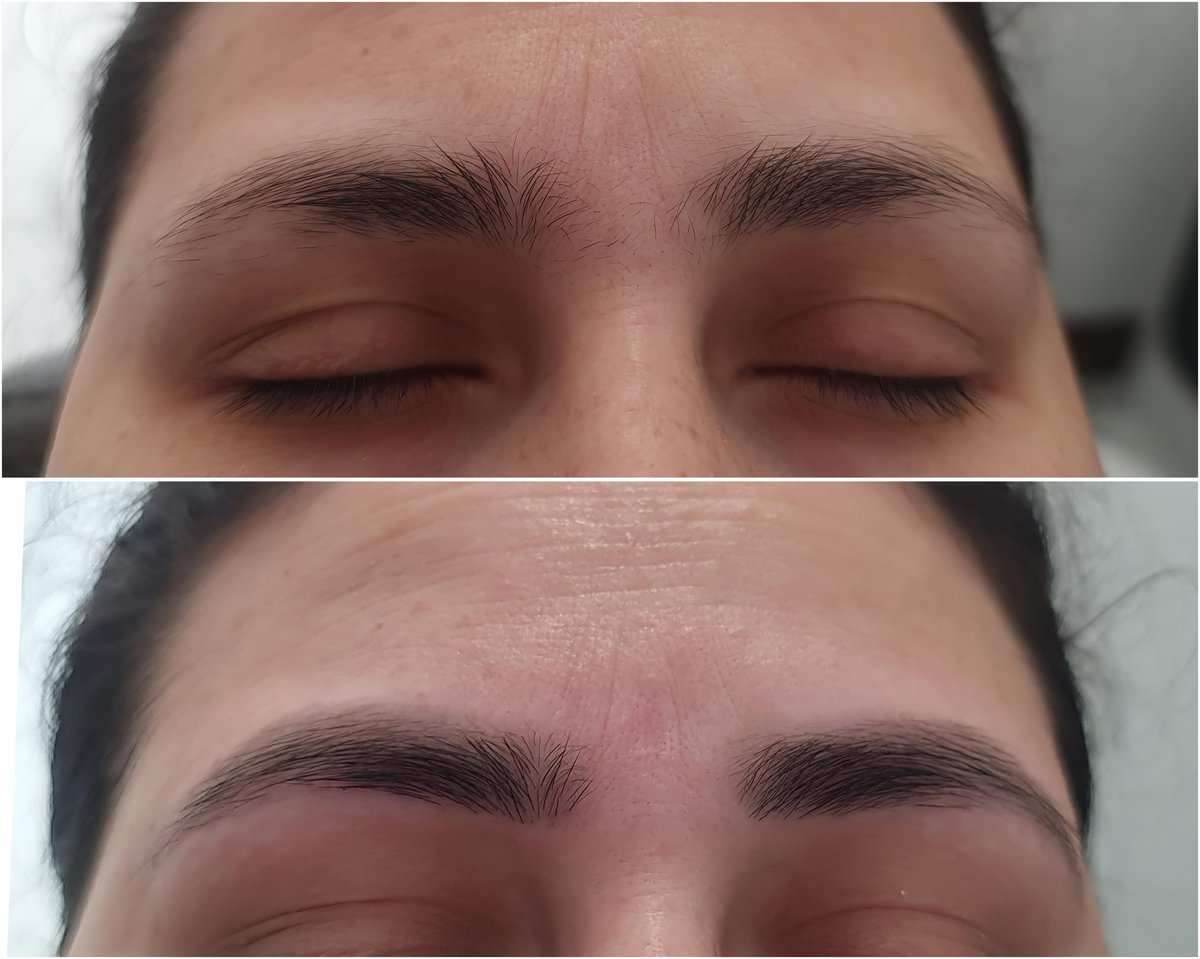 Eyebrow reshaping before and after at Aesthete Beauty Dundee
