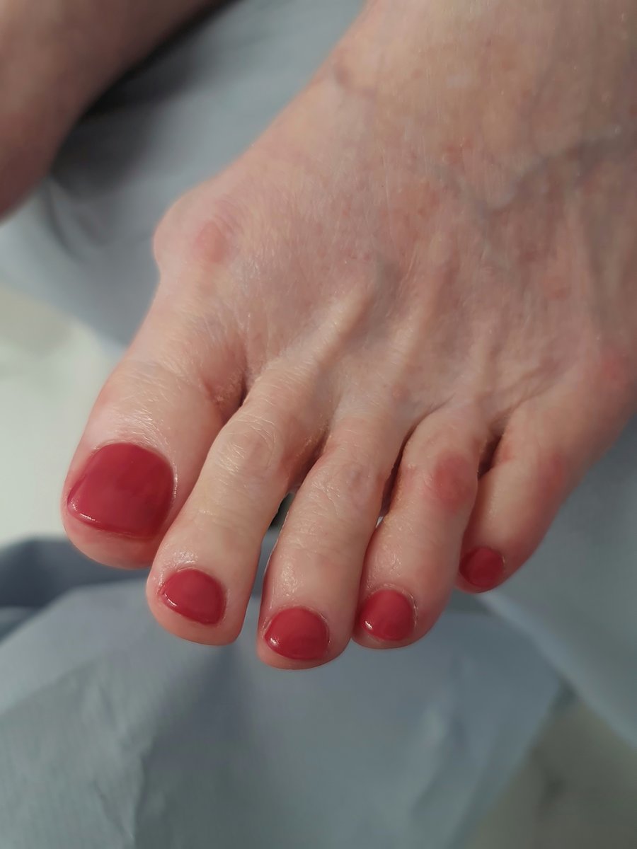 Classic red gel polish pedicure at Aesthete Beauty Dundee